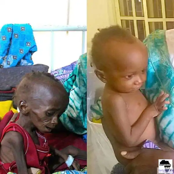 See how an NGO transformed the life of a malnourished IDP in Bama